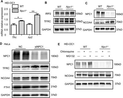 NPC1 Deficiency Contributes to Autophagy-Dependent Ferritinophagy in HEI-OC1 Auditory Cells